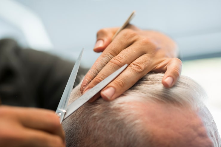 Are Hair Transplants Worth the Investment?